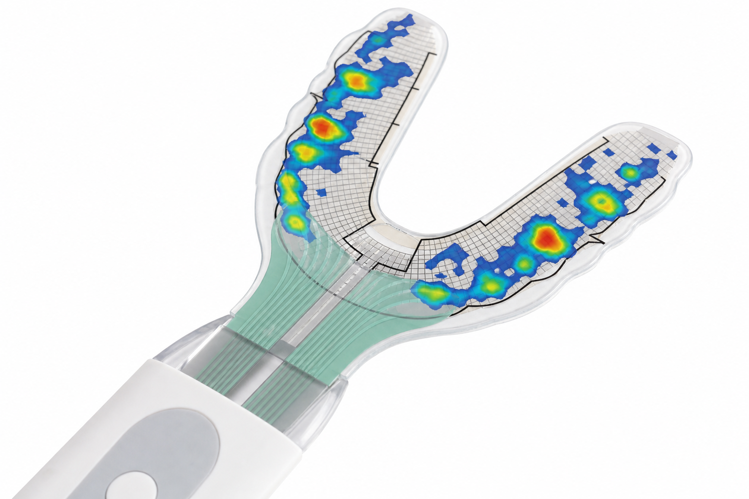 How Tekscan (T-Scan) Technology Perfects Your Bite