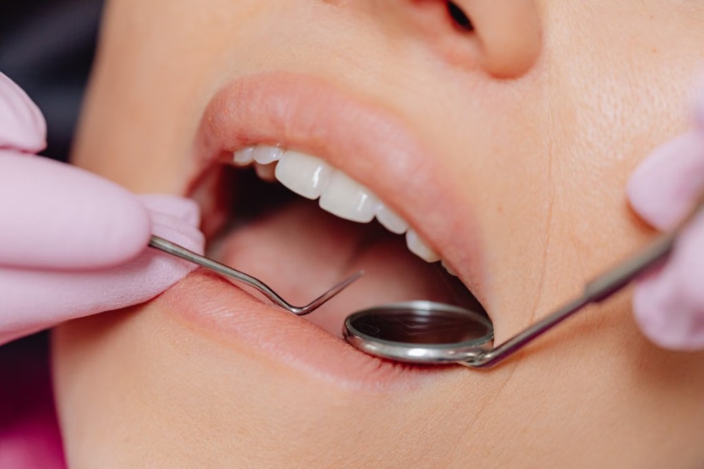Close-up of teeth being examined with dental mirror and probe during hygiene treatment