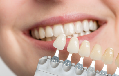 Dental shade guide held against a smiling patient for porcelain veneer colour matching