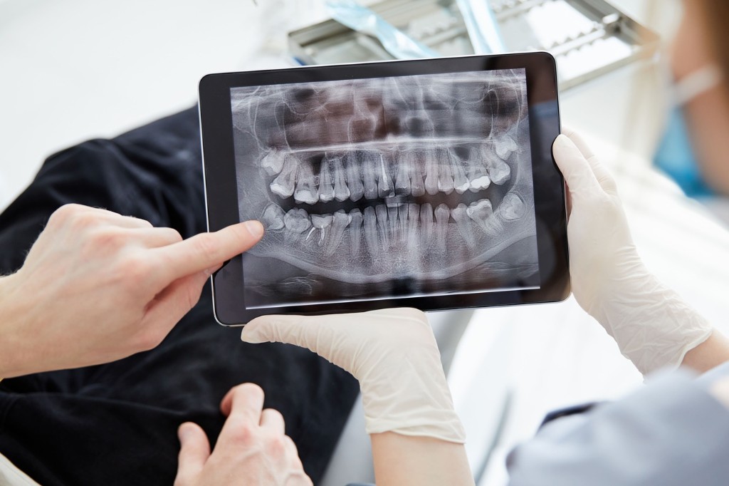 Dentist and patient reviewing a dental X-ray on a tablet